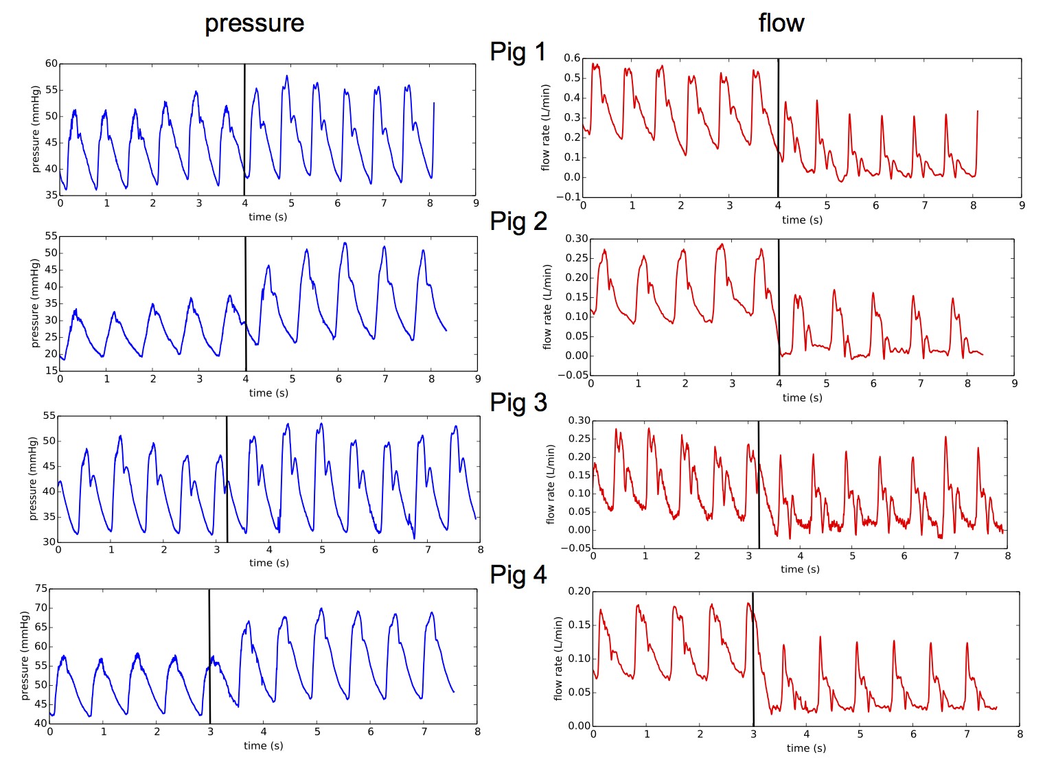 Pressure and flow measurements in hepatic artery at the resection time for 4 different animals black lines indicate the resection time